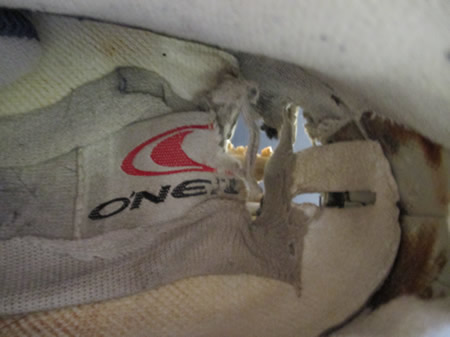 Worn out shoes - why do my feet hurt